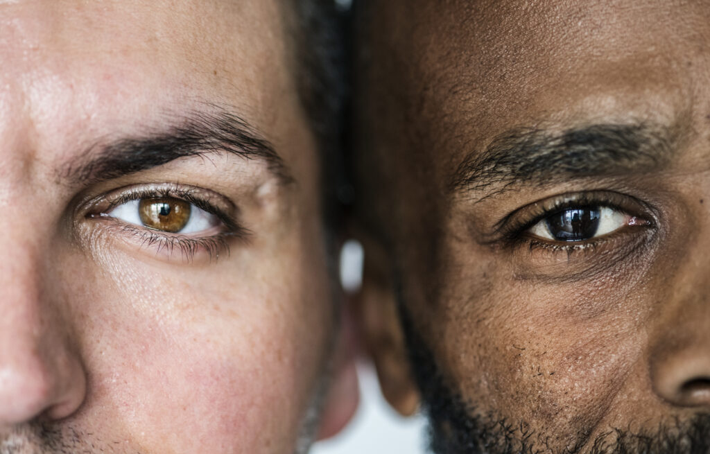 Blepharoplasty Blepharoplasty